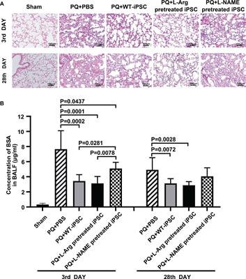 Nitric oxide-mediated the <mark class="highlighted">therapeutic properties</mark> of induced pluripotent stem cell for paraquat-induced acute lung injury